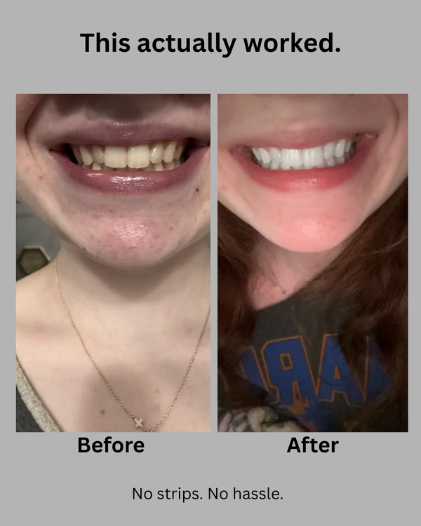 Instant Teeth Whitening Pen